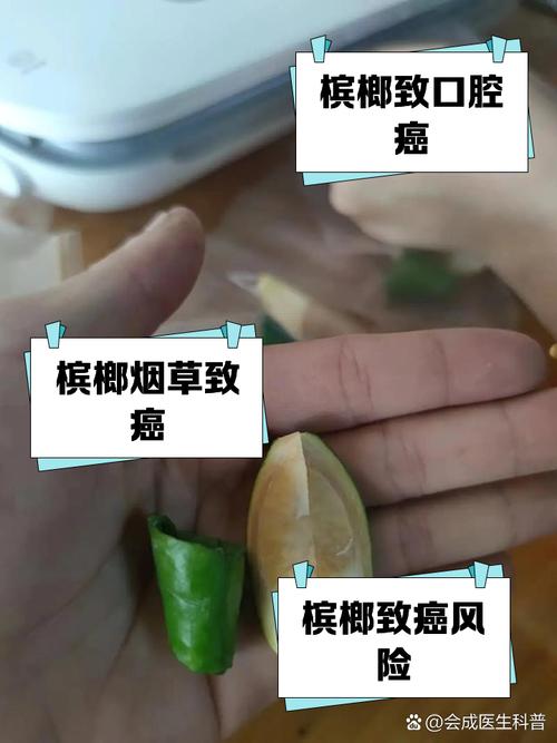 嚼槟榔20年患口腔癌,嚼槟榔20年患口腔癌几率大吗